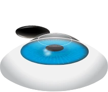 Corneal Flap is Created
